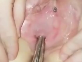 Urethral หูเจาะสองครั้ง